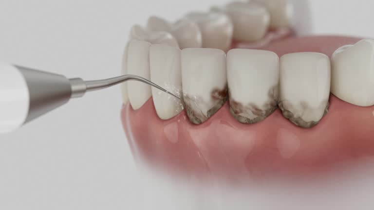 Reliable Tooth Extraction contractor in Beatrice, NE by Smile Center Dentistry